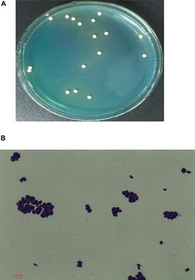 Isolation and Identification of a High-Yield Ethyl <mark class="highlighted">Caproate</mark>-Producing Yeast From Daqu and Optimization of Its Fermentation